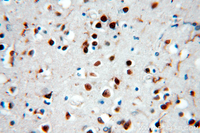 SNRPE Antibody in Immunohistochemistry (Paraffin) (IHC (P))