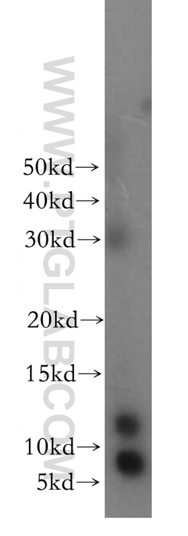 SNRPE Antibody in Western Blot (WB)