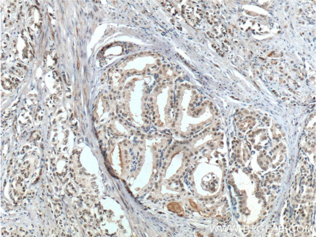 FOXA1 Antibody in Immunohistochemistry (Paraffin) (IHC (P))