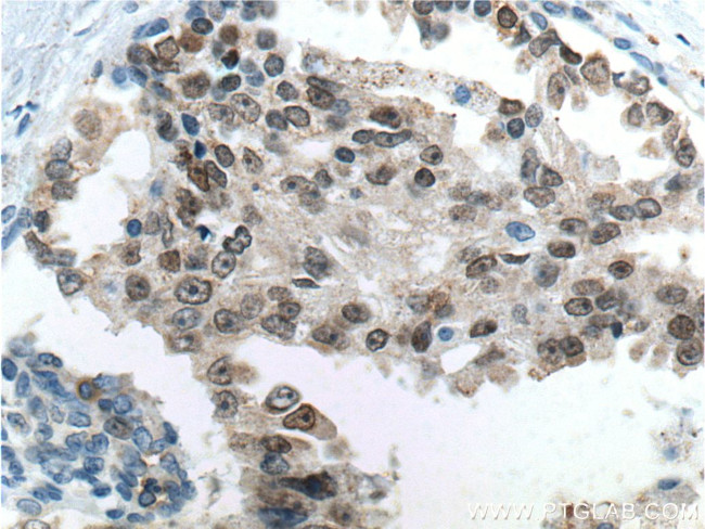 FOXA1 Antibody in Immunohistochemistry (Paraffin) (IHC (P))