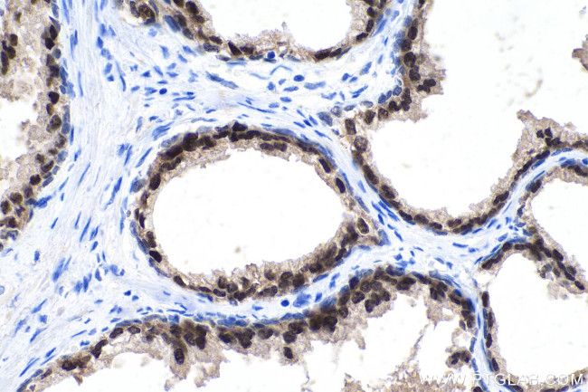 FOXA1 Antibody in Immunohistochemistry (Paraffin) (IHC (P))