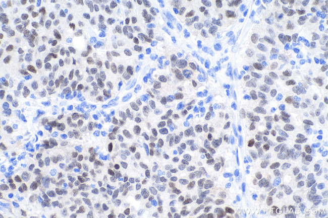 FOXA1 Antibody in Immunohistochemistry (Paraffin) (IHC (P))