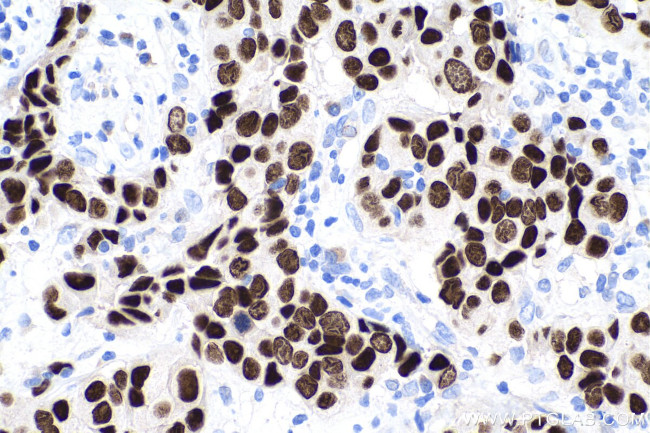 FOXA1 Antibody in Immunohistochemistry (Paraffin) (IHC (P))