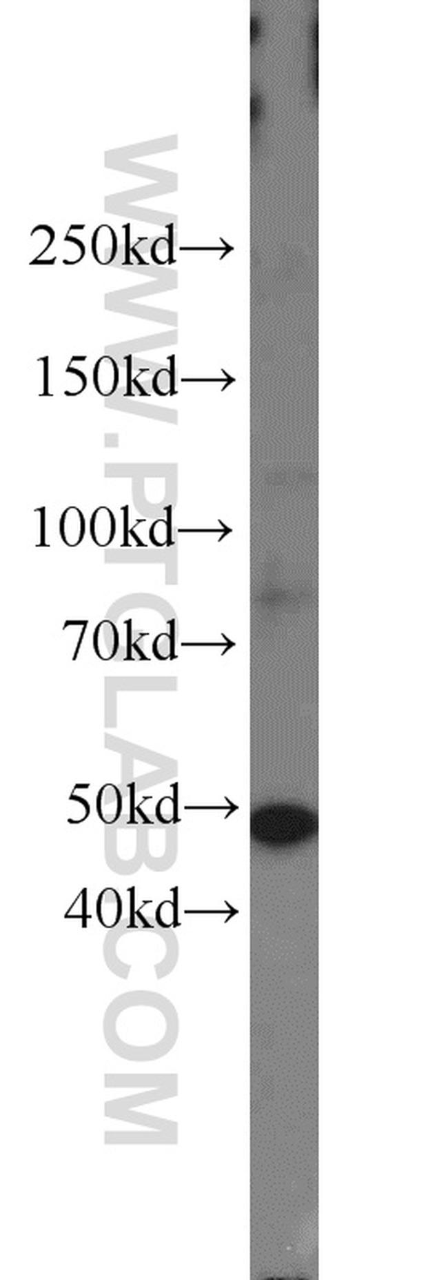 FOXA1 Antibody in Western Blot (WB)