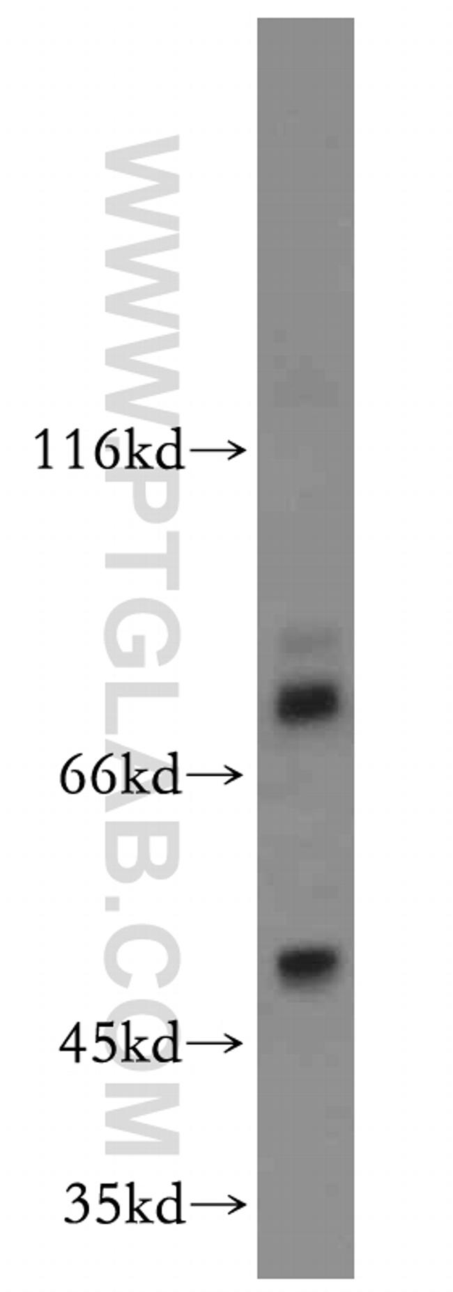 FOXA1 Antibody in Western Blot (WB)