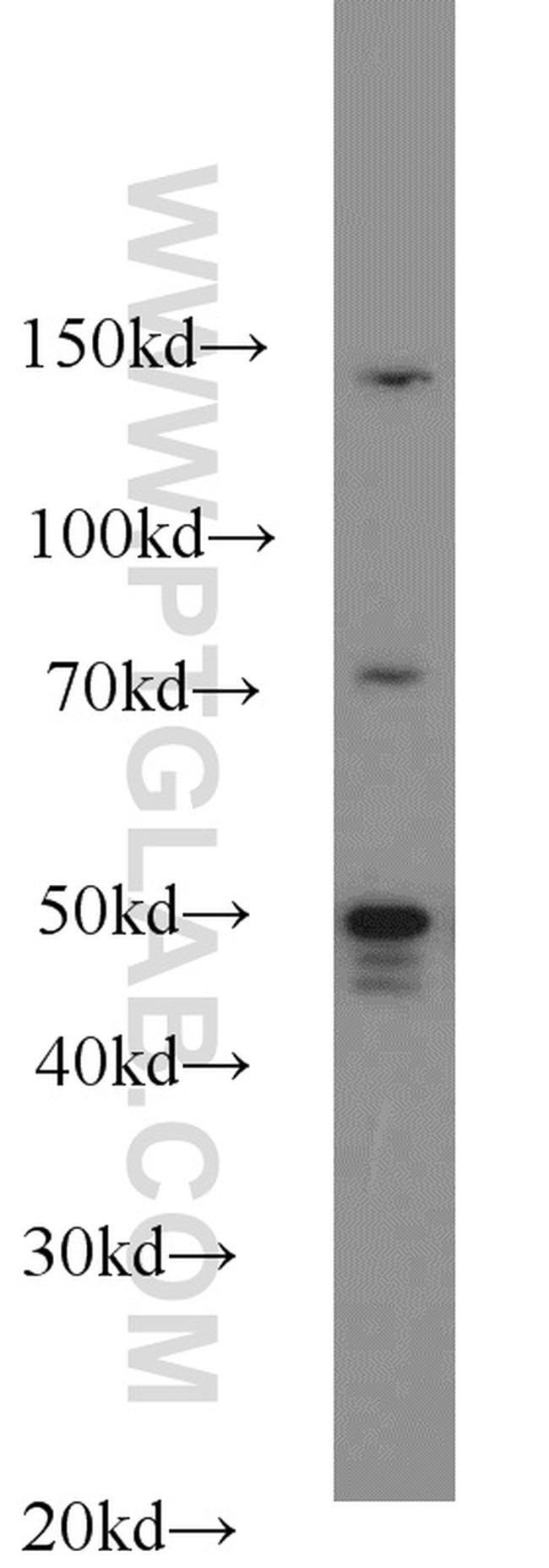 FOXA1 Antibody in Western Blot (WB)