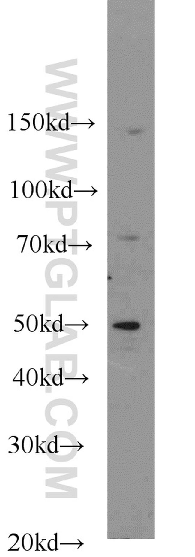 FOXA1 Antibody in Western Blot (WB)