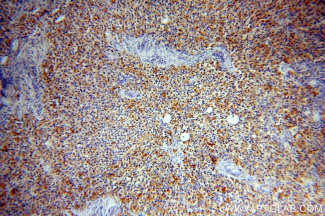 C11orf67 Antibody in Immunohistochemistry (Paraffin) (IHC (P))