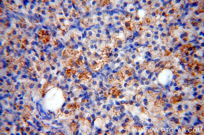 C11orf67 Antibody in Immunohistochemistry (Paraffin) (IHC (P))