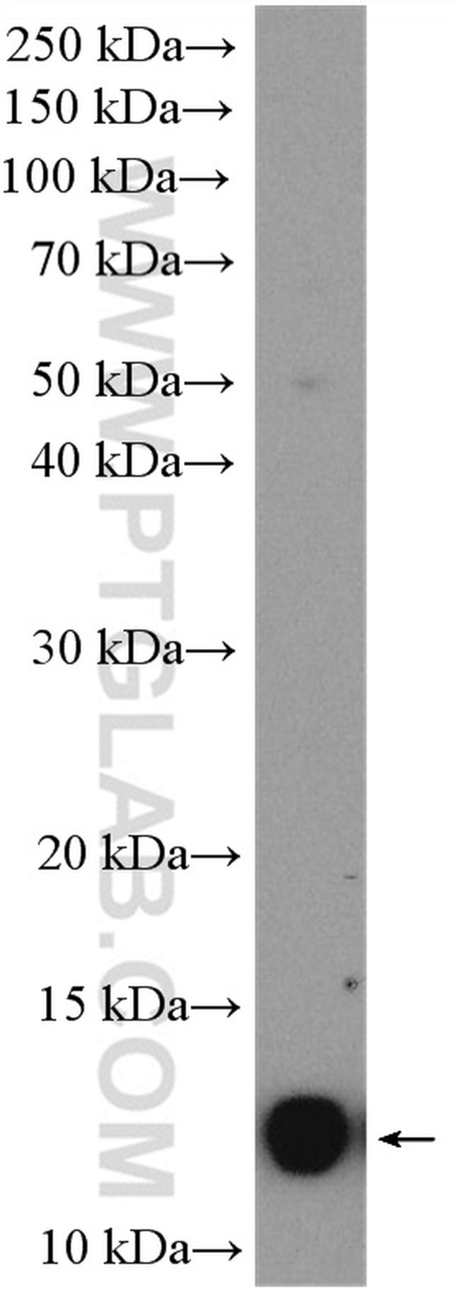 C11orf67 Antibody in Western Blot (WB)