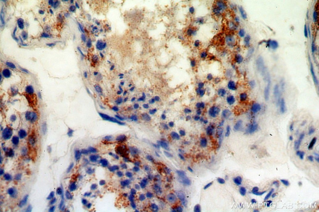 C11orf67 Antibody in Immunohistochemistry (Paraffin) (IHC (P))