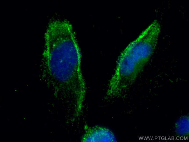 MIF Antibody in Immunocytochemistry (ICC/IF)