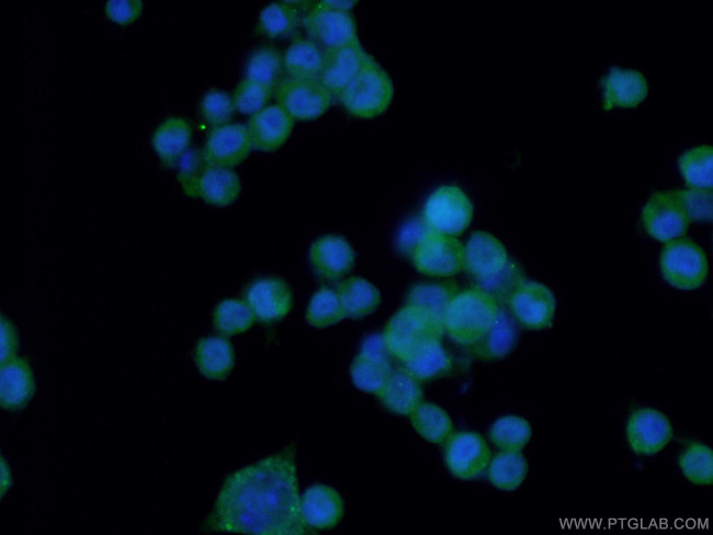 MIF Antibody in Immunocytochemistry (ICC/IF)