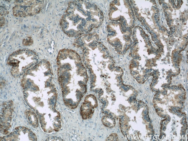 MIF Antibody in Immunohistochemistry (Paraffin) (IHC (P))