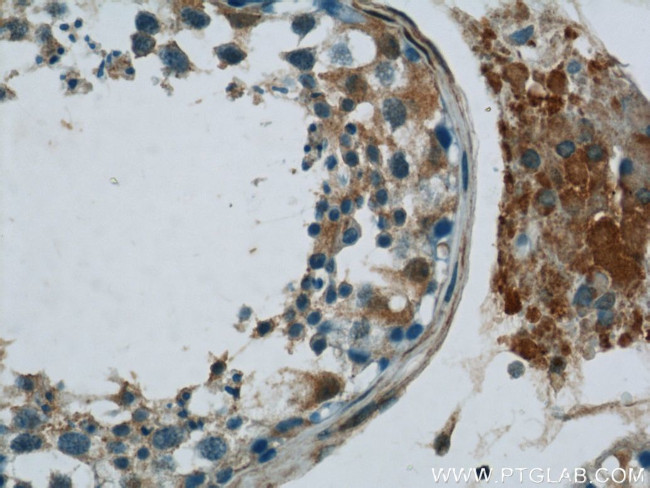 MIF Antibody in Immunohistochemistry (Paraffin) (IHC (P))