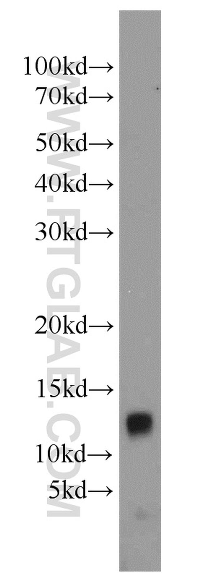 MIF Antibody in Western Blot (WB)