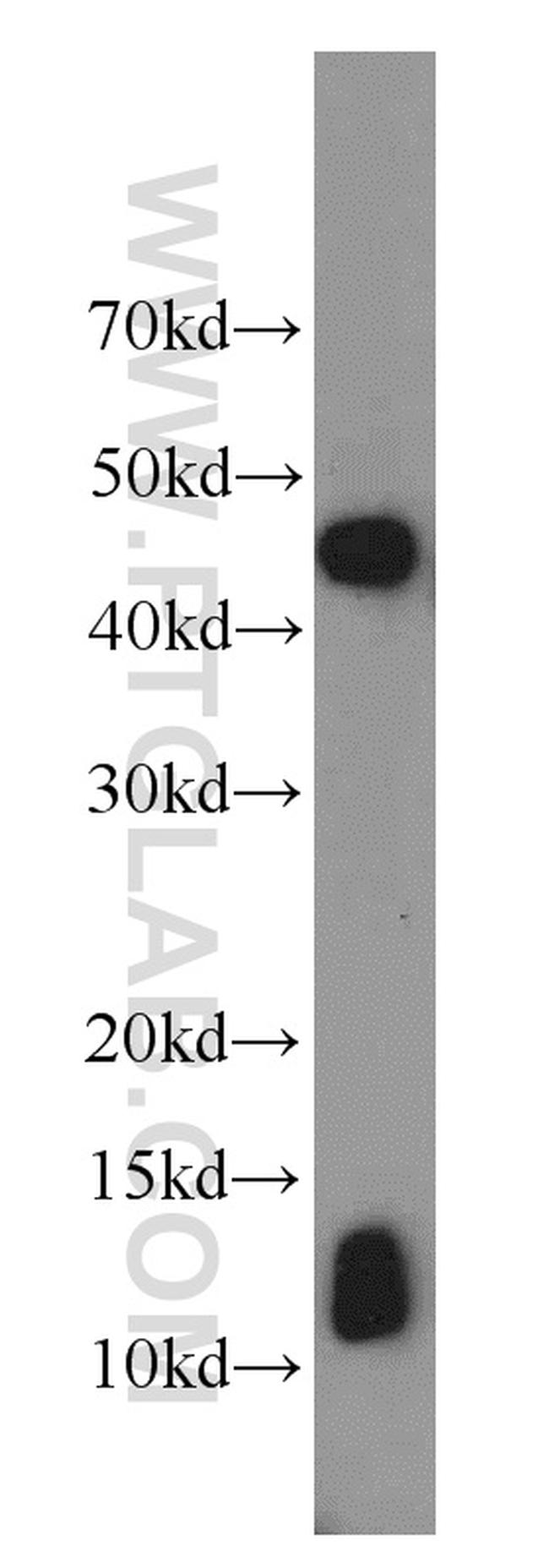 MIF Antibody in Western Blot (WB)