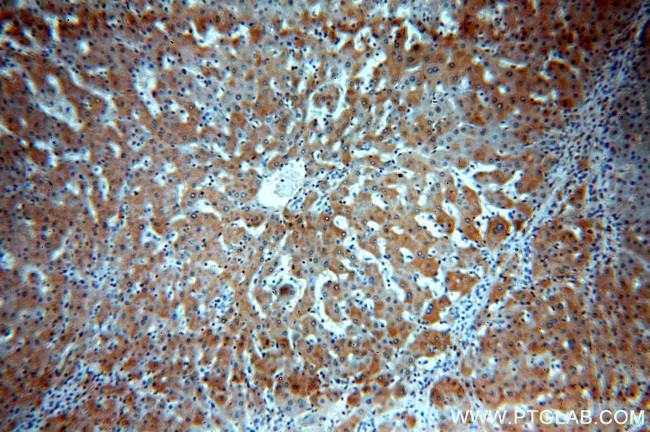 SPP Antibody in Immunohistochemistry (Paraffin) (IHC (P))