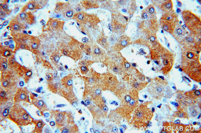 SPP Antibody in Immunohistochemistry (Paraffin) (IHC (P))