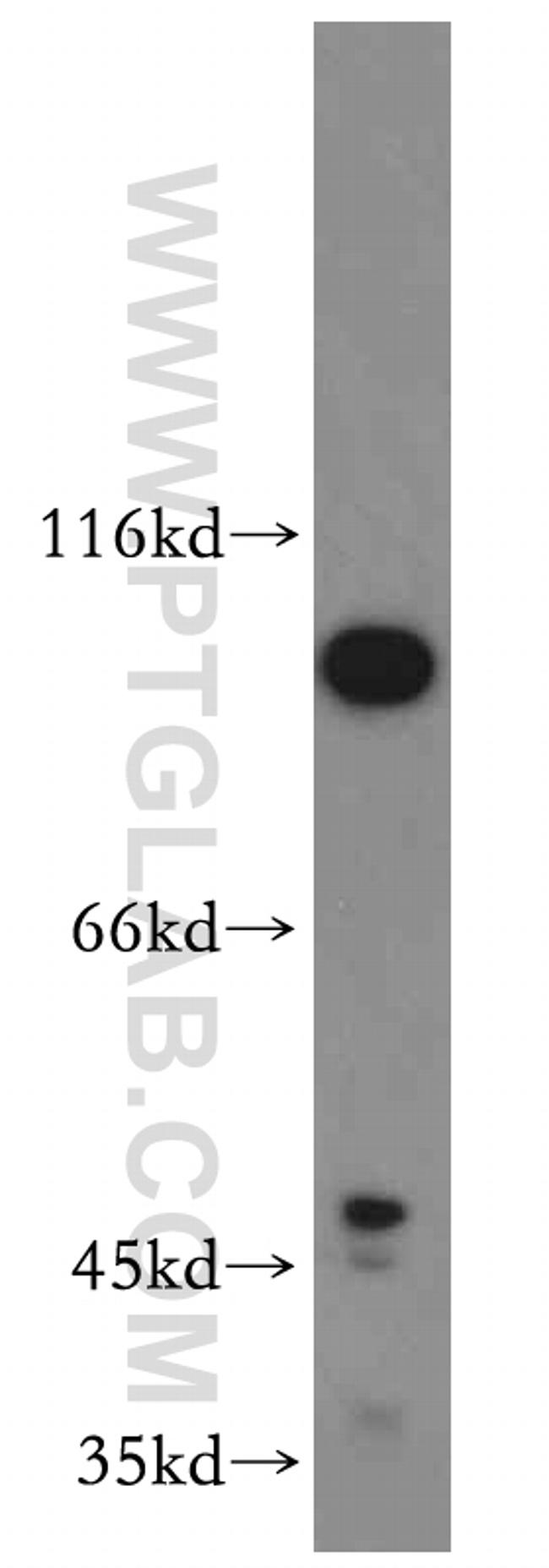 SPP Antibody in Western Blot (WB)