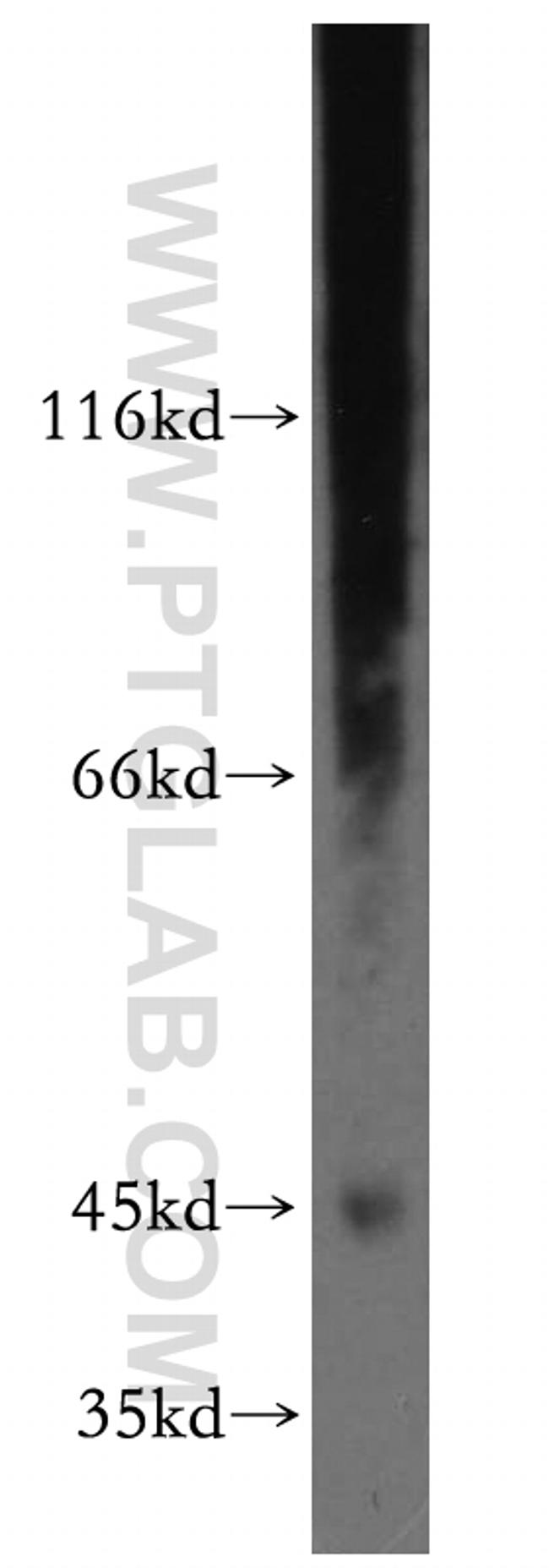 SPP Antibody in Western Blot (WB)