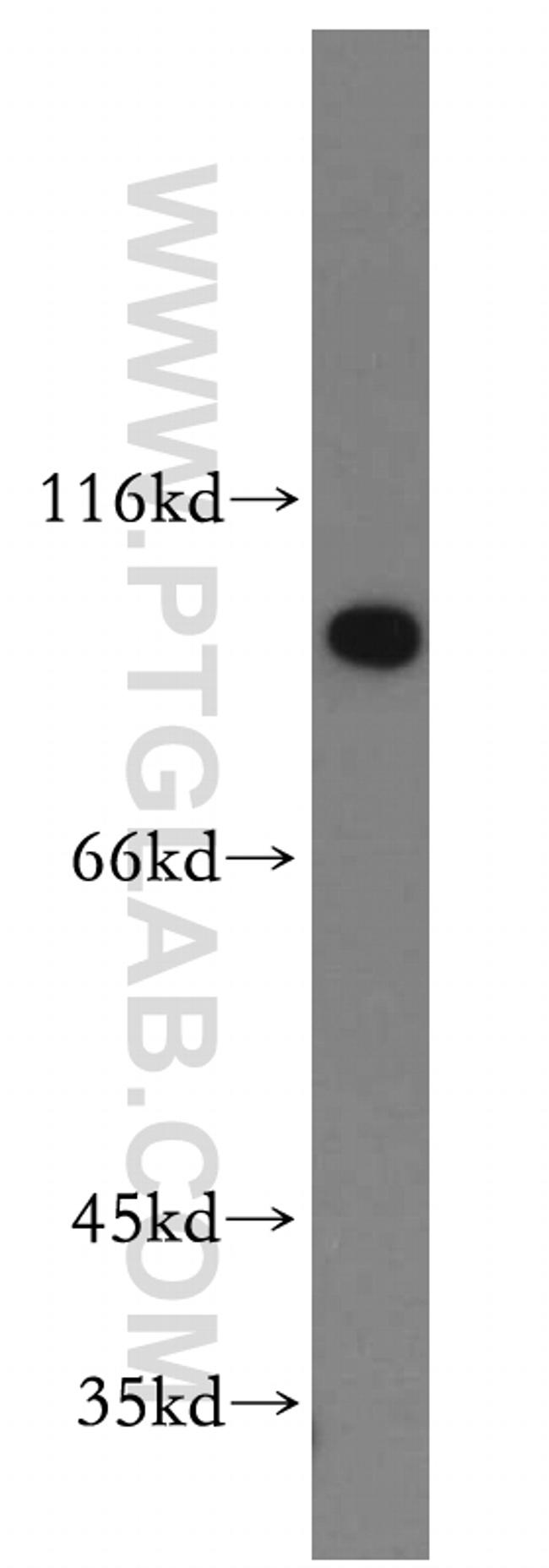 SPP Antibody in Western Blot (WB)