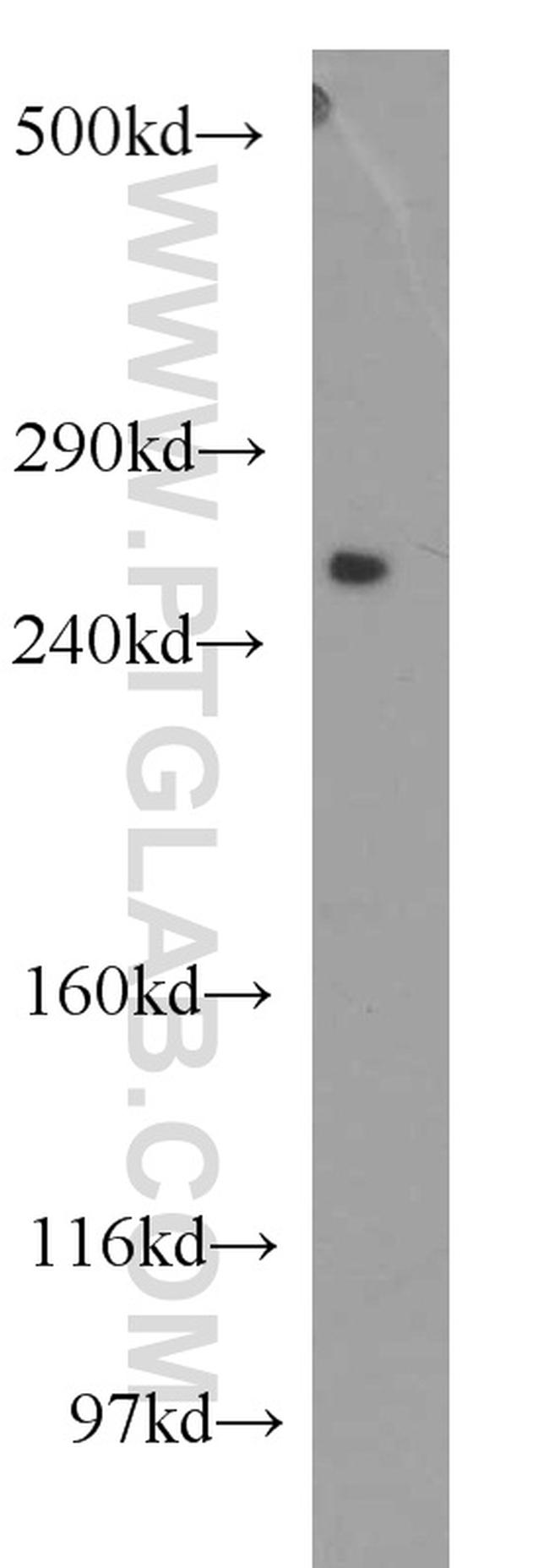 PCNXL2 Antibody in Western Blot (WB)