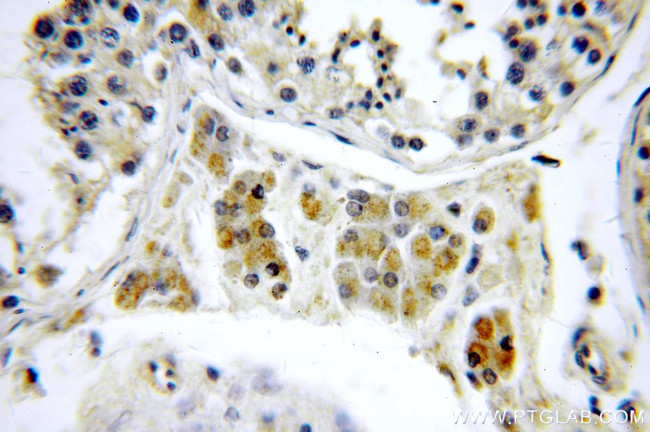 PIGM Antibody in Immunohistochemistry (Paraffin) (IHC (P))