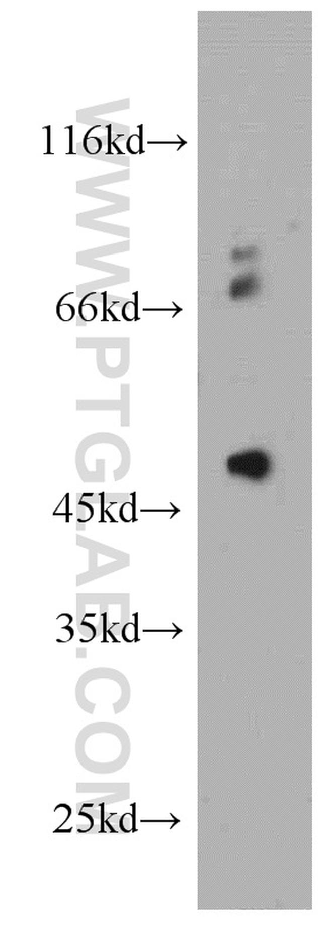 PIGM Antibody in Western Blot (WB)