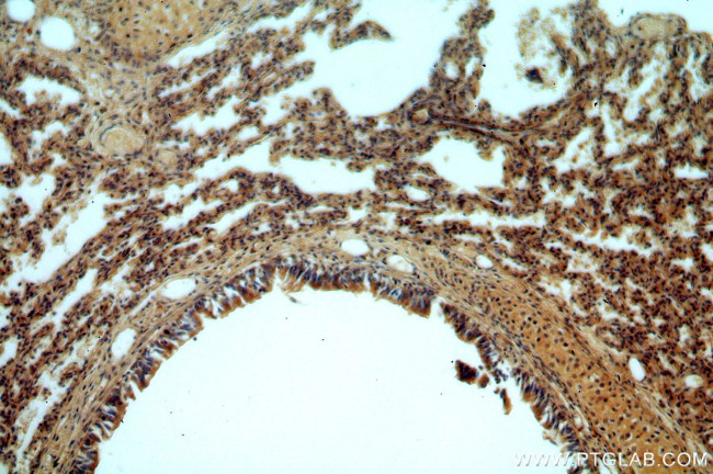 B3GNT5 Antibody in Immunohistochemistry (Paraffin) (IHC (P))