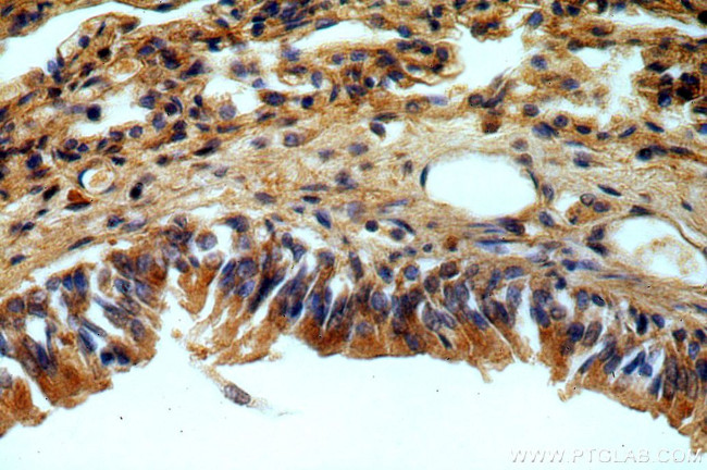 B3GNT5 Antibody in Immunohistochemistry (Paraffin) (IHC (P))