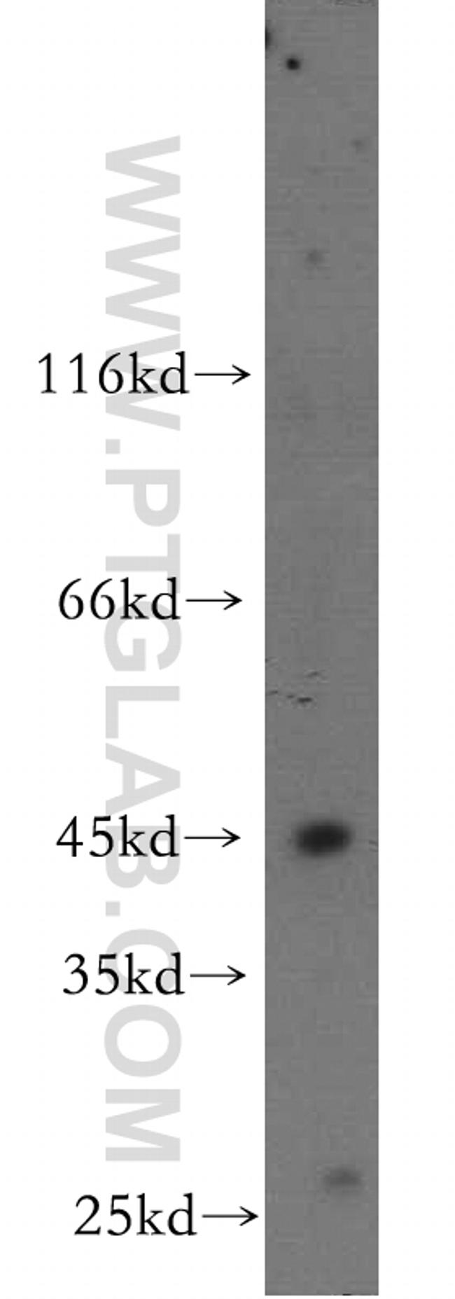 B3GNT5 Antibody in Western Blot (WB)