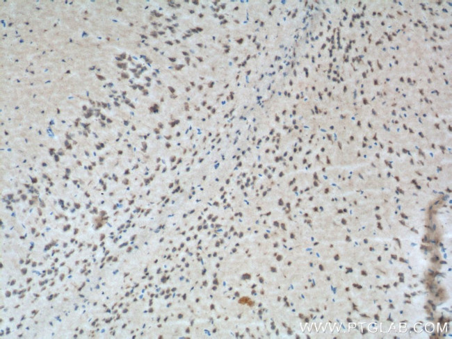 CXCR7 Antibody in Immunohistochemistry (Paraffin) (IHC (P))