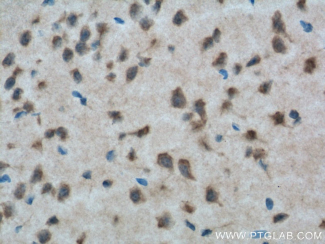 CXCR7 Antibody in Immunohistochemistry (Paraffin) (IHC (P))