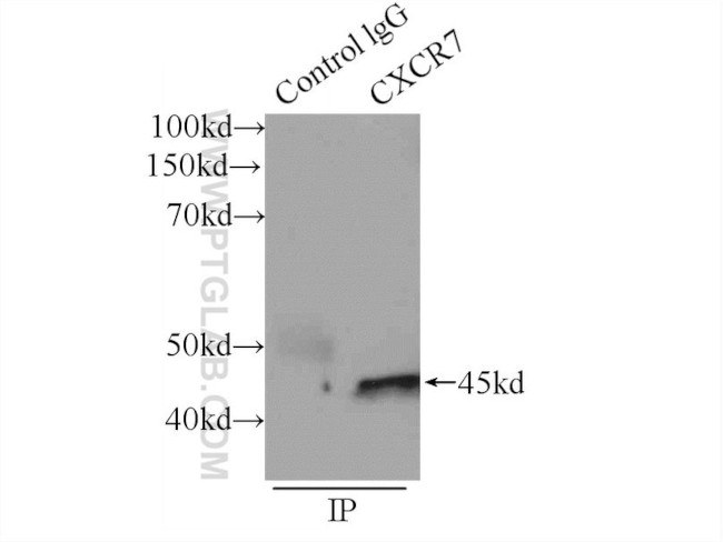 CXCR7 Antibody in Immunoprecipitation (IP)