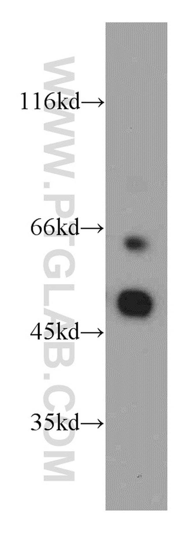 CXCR7 Antibody in Western Blot (WB)