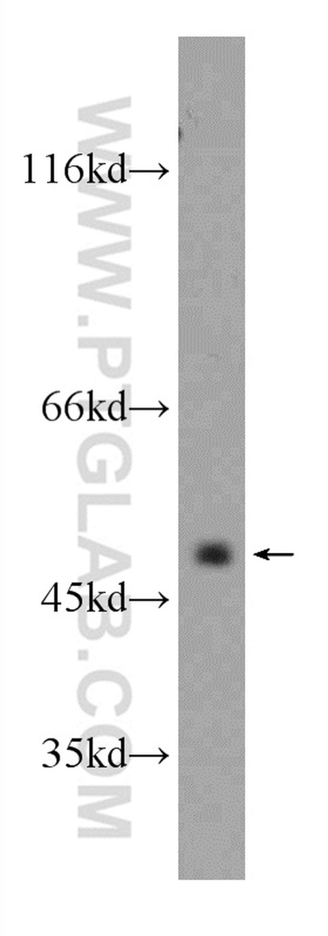 CXCR7 Antibody in Western Blot (WB)