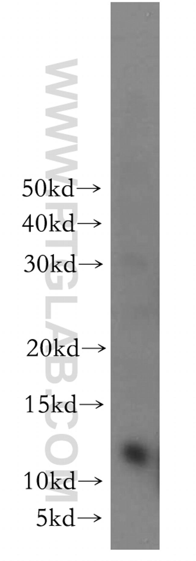 CCDC56 Antibody in Western Blot (WB)