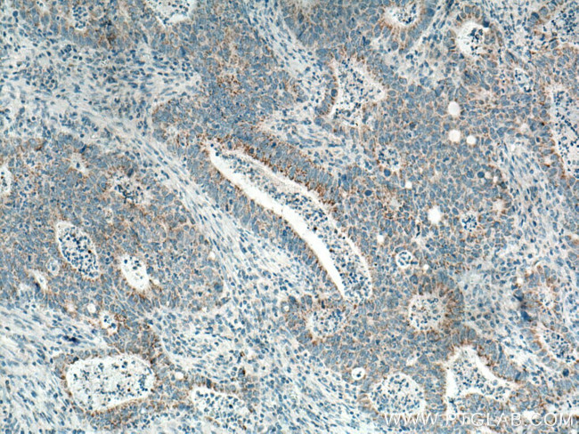 CCDC56 Antibody in Immunohistochemistry (Paraffin) (IHC (P))