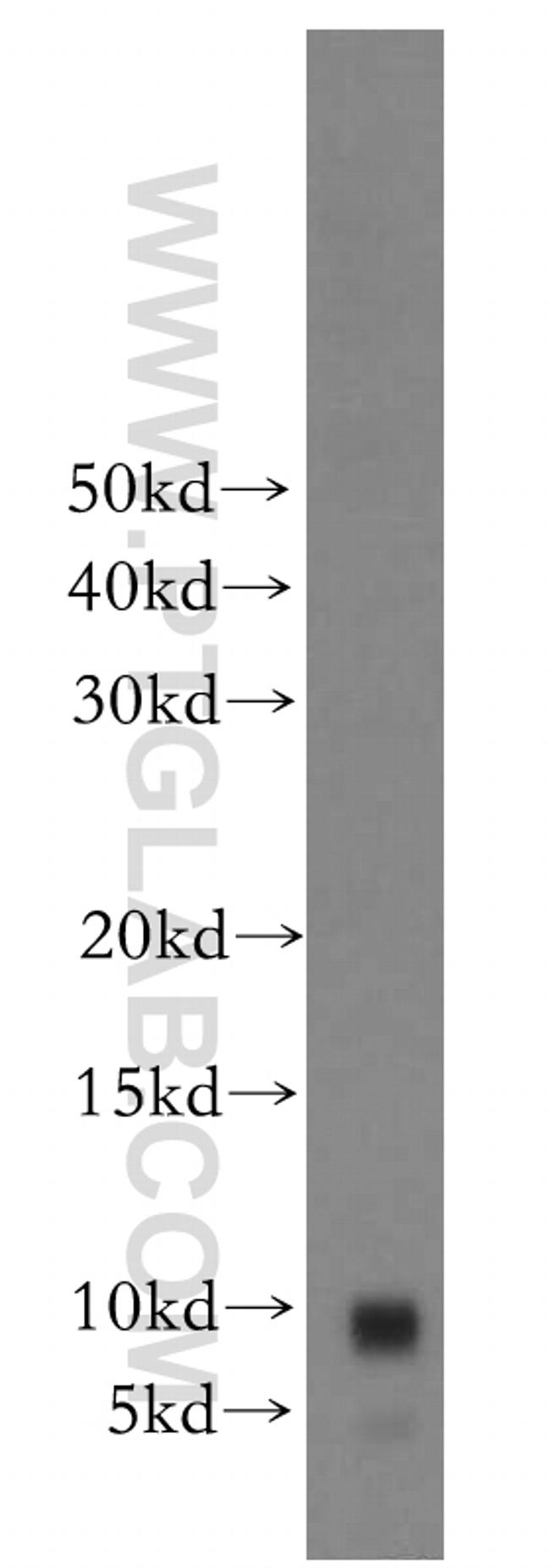 CCDC56 Antibody in Western Blot (WB)