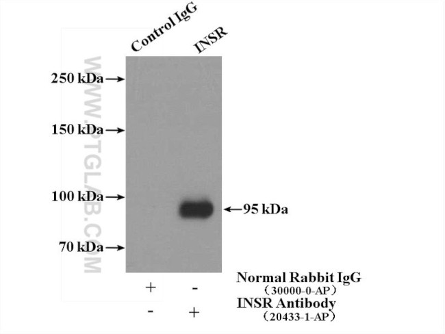 INSR Antibody in Immunoprecipitation (IP)