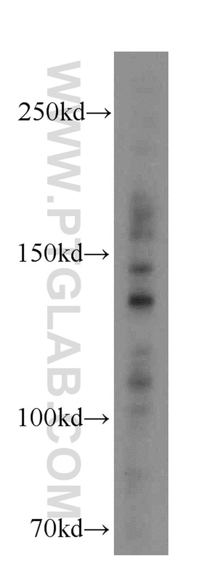 INSR Antibody in Western Blot (WB)