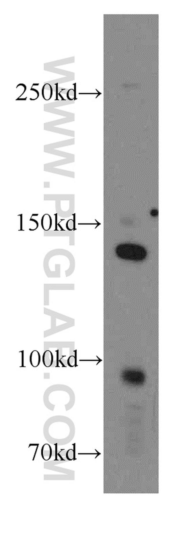 INSR Antibody in Western Blot (WB)