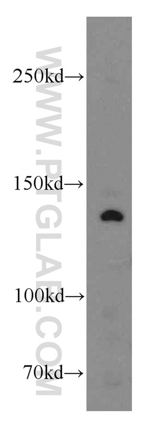 INSR Antibody in Western Blot (WB)