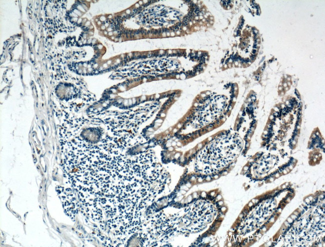 GLUT2 Antibody in Immunohistochemistry (Paraffin) (IHC (P))