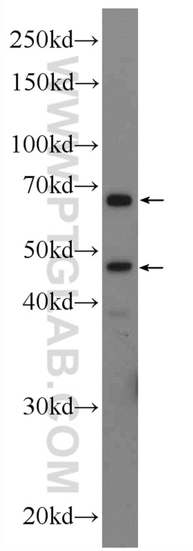 GLUT2 Antibody in Western Blot (WB)