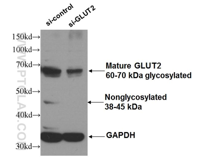 GLUT2 Antibody in Western Blot (WB)