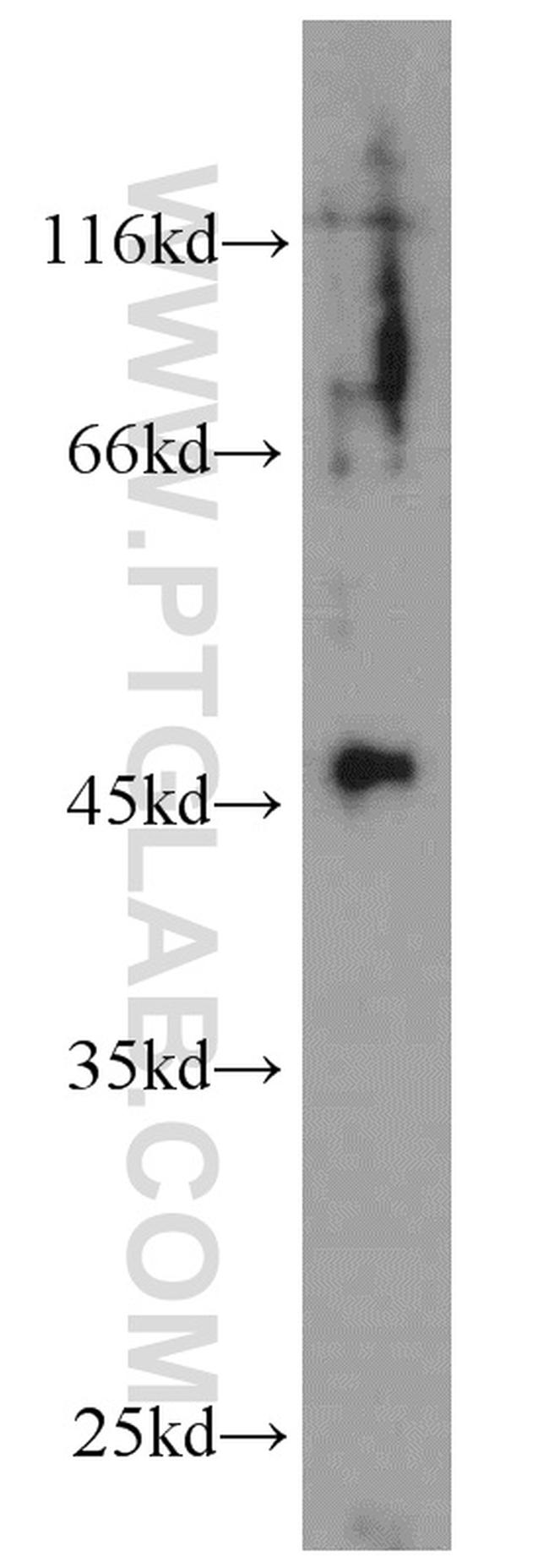 EDG2 Antibody in Western Blot (WB)