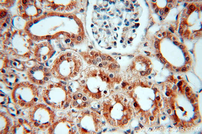 SMN Antibody in Immunohistochemistry (Paraffin) (IHC (P))