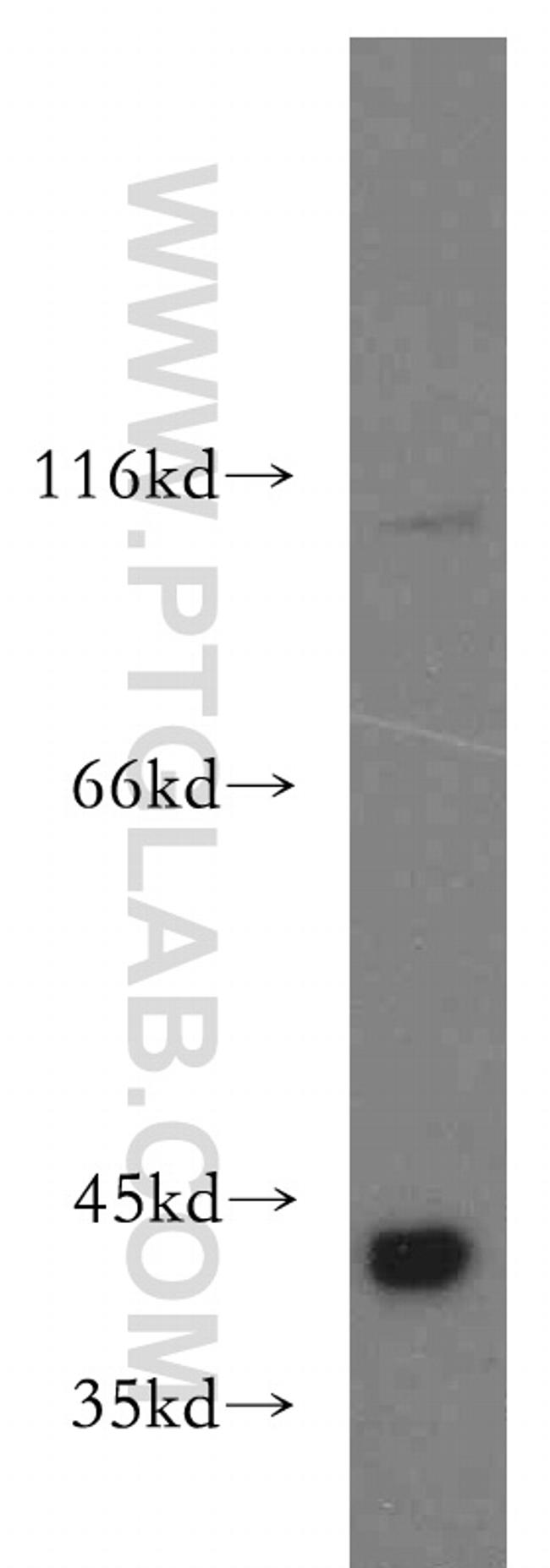 SMN Antibody in Western Blot (WB)